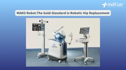 MAKO Robot system for orthopedic surgery, illustrating the advanced robotic arm and accompanying screens used for MAKO Robotic Hip Replacement in India.